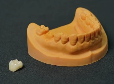 Zirconia Dental Crowns: Οδηγώντας μια νέα τάση στην οδοντική αποκατάσταση