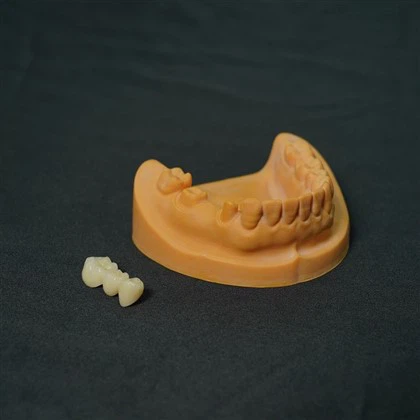 Εμφύτευμα Full Zirconia Crown